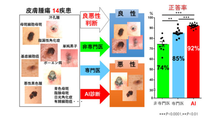 筑波大学とKCCS、皮膚腫瘍の鑑別能力が専門医よりも高いAIシステムを