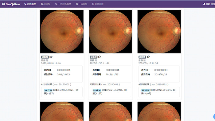 眼病変一発診断100 一目で見抜く診断の要点 メジカルビュー社｜眼科｜一目でわかる眼疾患の見分け方 上巻