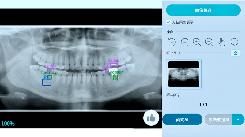 スタフネ口腔X線診断学 aoi_ai_1.jpg
